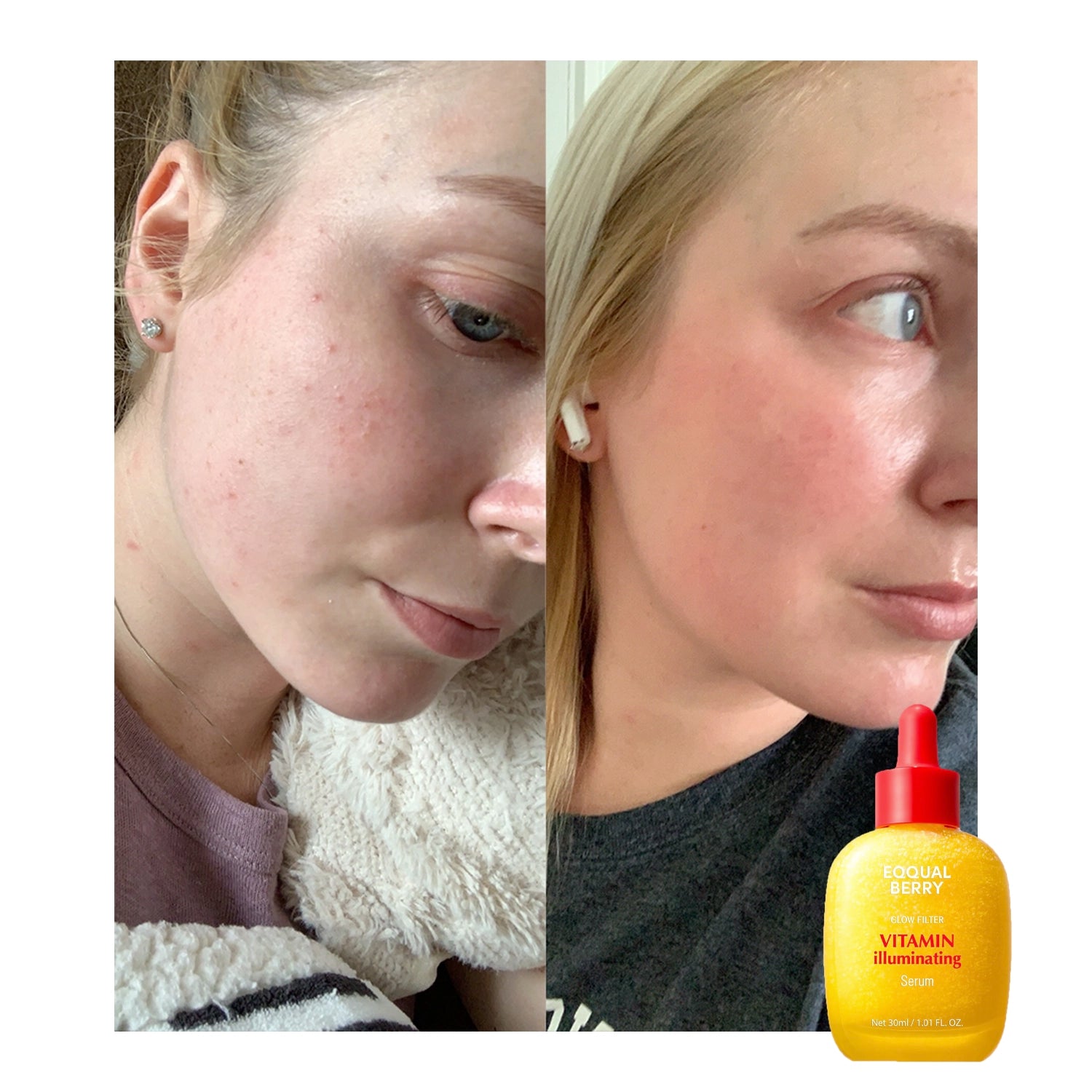 Vitamin Illuminating Serum