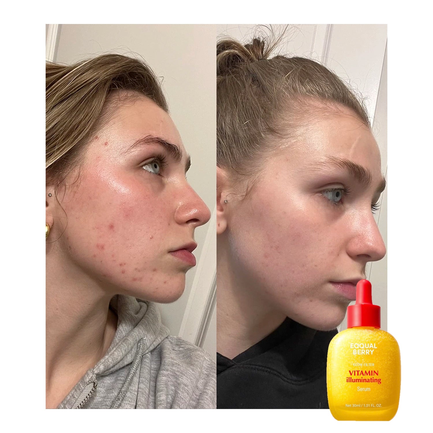 Vitamin Illuminating Serum